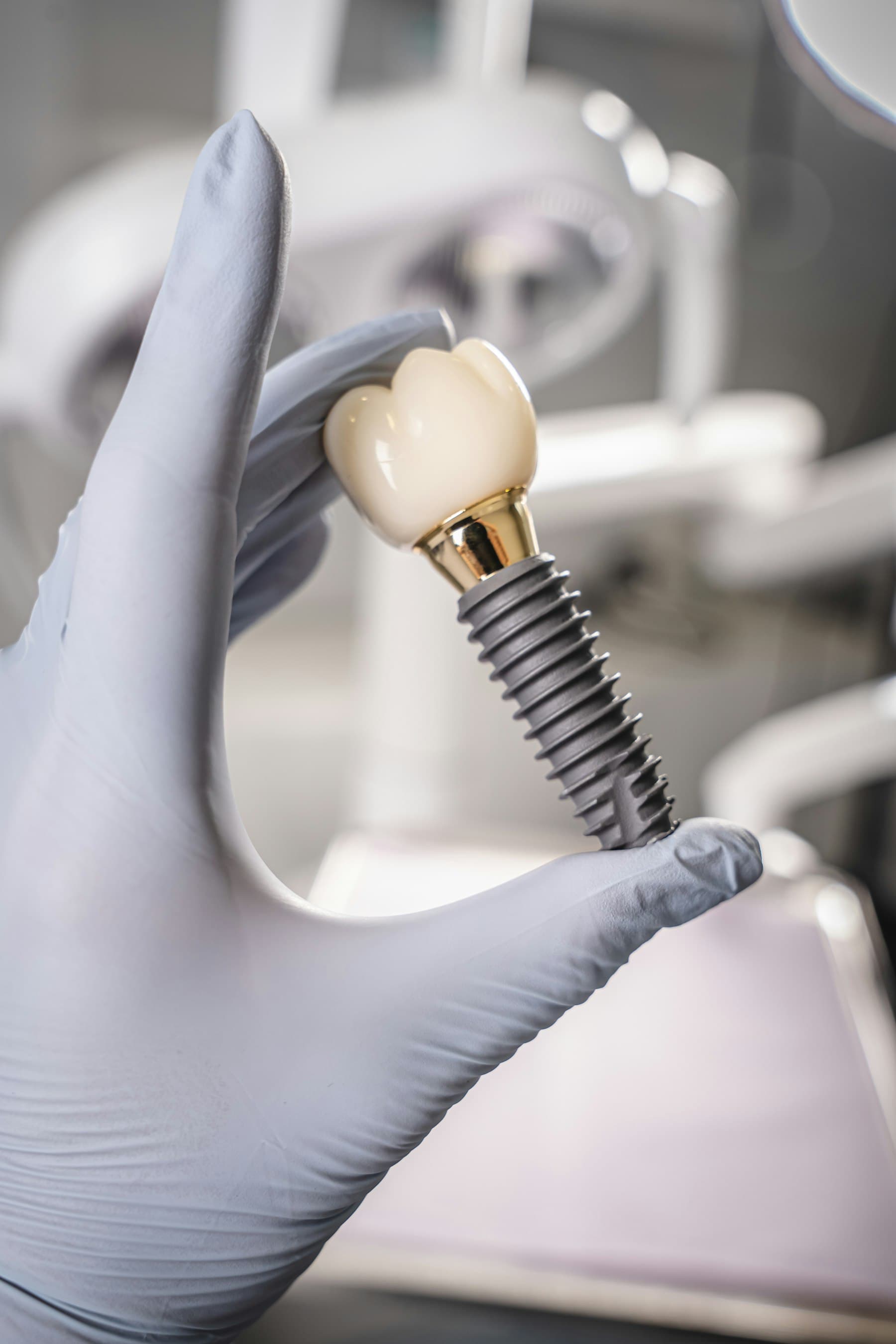 Eldivenli elde implant ve üzerindeki kron